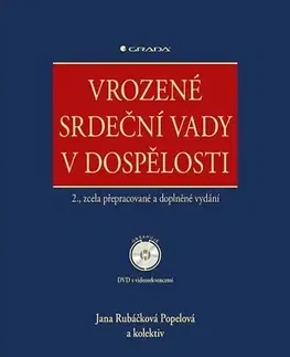 Medicína - ostatné Vrozené srdeční vady v dospělosti + DVD - 2. vydání - Jana Rubáčková Popelová,Kolektív autorov