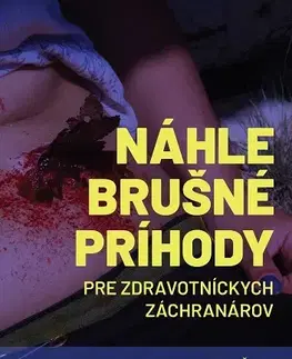 Medicína - ostatné Náhle brušné príhody pre zdravotníckych záchranárov - Marián Šanta,Silvia Farkašová Iannaccone,Imrich Andrási