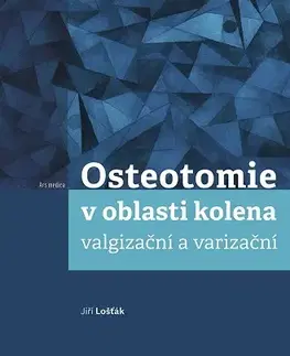 Chirurgia, ortopédia, traumatológia Osteotomie v oblasti kolena: valgizační a varizační - Jiří Lošťák