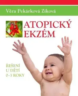 Medicína - ostatné Atopický ekzém - Věra Pekárková Zíková