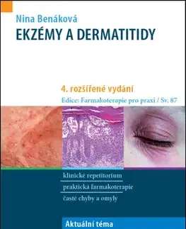 Medicína - ostatné Ekzémy a dermatitidy, 4. vydání - Nina Benáková