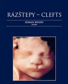 Medicína - ostatné Rázštepy - Clefts - Roman Bánsky