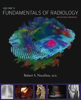 Medicína - ostatné Squires Fundamentals of Radiology - Robert A. Novelline