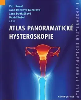 Medicína - ostatné Atlas panoramatické hysteroskopie - Kolektív autorov