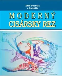 Gynekológia a pôrodníctvo Moderný cisársky rez + CD - Kolektív autorov,Erik Dosedla