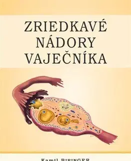 Onkológia Zriedkavé nádory vaječníka - Kamil Biringer
