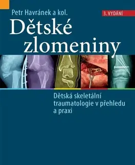 Chirurgia, ortopédia, traumatológia Dětské zlomeniny, 3. vydání - Petr Havránek