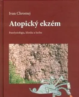 Medicína - ostatné Atopický ekzém - Ivan Chromej