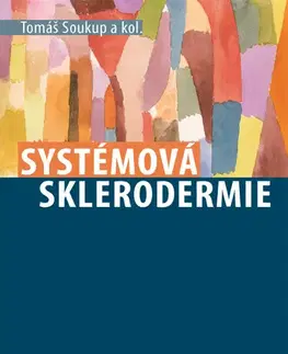 Medicína - ostatné Systémová sklerodermie - Tomáš Soukup
