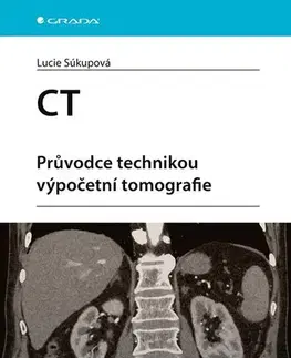 Medicína - ostatné CT - Průvodce technikou výpočetní tomografie - Lucie Súkupová