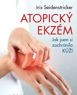 Alternatívna medicína - ostatné Jak jsem si zachránila kůži - Iris Seidenstricker