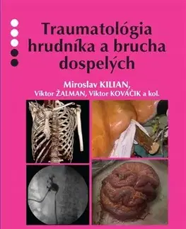 Chirurgia, ortopédia, traumatológia Traumatológia hrudníka a brucha dospelých - Kilian Miroslav,Kolektív autorov
