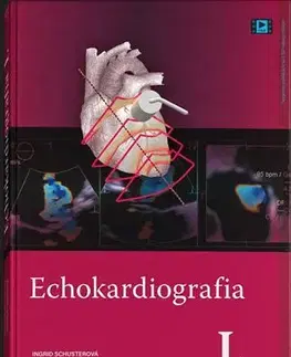 Medicína - ostatné Echokardiografia I. - Ingrid Schusterová