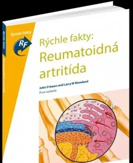 Medicína - ostatné Rýchle fakty: Reumatoidná artritída - Kolektív autorov