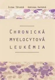 Onkológia Chronická myelocytová leukémia - Adriana Kafková,Elena Tóthová