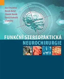 Medicína - ostatné Funkční stereotaktická neurochirurgie - Kolektív autorov