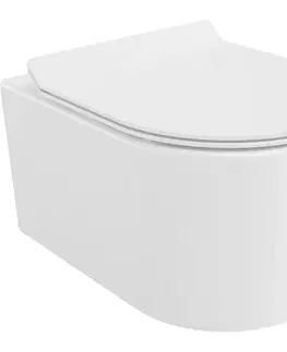 Záchody MEXEN/S - Sofia Závesná WC misa Rimless Tornado vrátane sedátka s slow slim, duroplast, biela lesk 30540100T