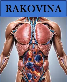 Medicína - ostatné Rakovina - Ivana Hasalová