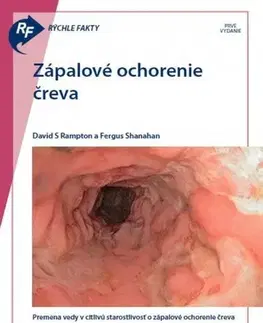 Medicína - ostatné Rýchle fakty: Zápalové ochorenie čreva - Kolektív autorov