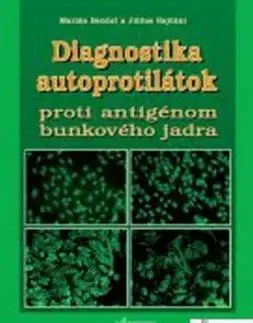 Medicína - ostatné Diagnostika autoprotilátok proti antigénom bunkové - Marián Benčat,Július Rajčáni