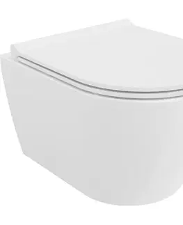 Záchody MEXEN/S - Carmen Závesná WC misa Rimless Tornado vrátane sedátka s slow slim, duroplast, biela lesk 30880500T