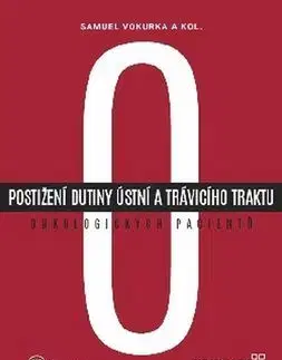 Onkológia Postižení dutiny ústní a trávicího traktu onkologických pacientů - Kolektív autorov,Samuel Vokurka