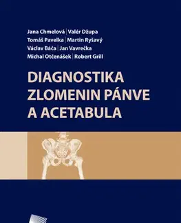 Medicína - ostatné Diagnostika zlomenin pánve a acetabula - Valér Džupa,Tomáš Pavelka,Stanislav Taller