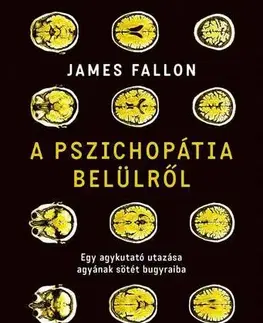 Psychológia, etika A pszichopátia belülről - James Fallon,Dudik Annamária Éva