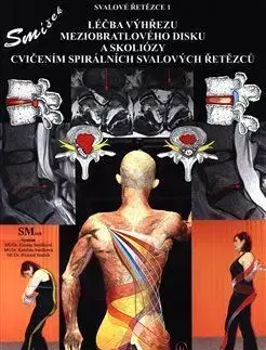 Medicína Léčba výhřezu meziobratlového disku bez operace - Richard Smíšek,Kateřina Smíšková,Zuzana Smíšková