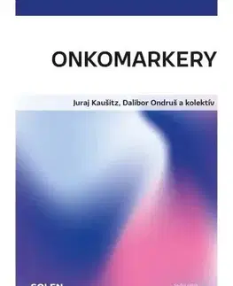 Onkológia Onkomarkery - Juraj Kaušitz,Dalibor Ondruš