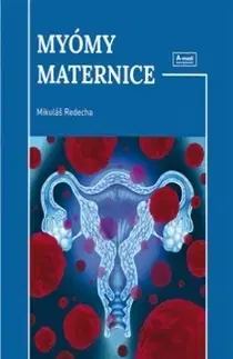 Gynekológia a pôrodníctvo Myómy maternice - Mikuláš Redecha