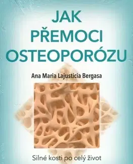 Zdravoveda, ochorenia, choroby Jak přemoci osteoporózu - Anna Maria Lajusticia Bergasa