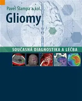 Medicína - ostatné Gliomy - současná diagnostika a léčba - Pavel Šlampa