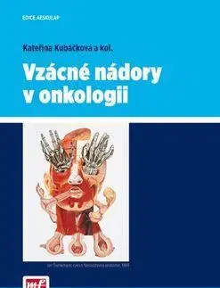 Medicína - ostatné Vzácné nádory v onkologii - Kateřina Kubáčková