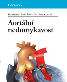 Medicína - ostatné Aortální nedomykavost - Kolektív autorov