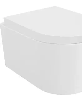 Záchody MEXEN/S - Sofia Závesná WC misa Rimless Tornado vrátane sedátka s slow, duroplast, biela lesk 30540200T