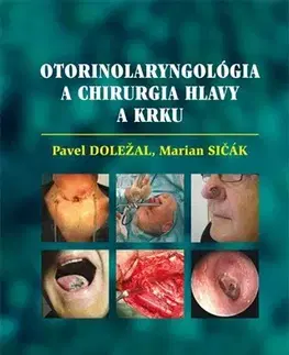 Medicína - ostatné Otorinolaryngológia a chirurgia hlavy a krku - Pavel Doležal,Marián Sičák