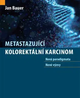 Onkológia Metastazující kolorektální karcinom - Jan Bauer