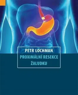 Chirurgia, ortopédia, traumatológia Proximální resekce žaludku - Petr Lochman