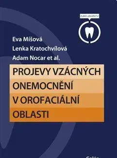 Stomatológia Projevy vzácných onemocnění v orofaciální oblasti - Eva Míšová,Lenka Kratochvílová,Adam Nocar