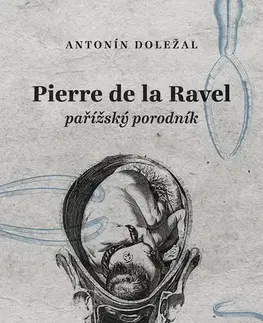 Česká beletria Pierre de la Ravel, pařížský porodník - Antonín Doležal