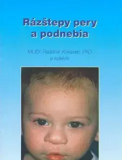 Medicína - ostatné Rázštepy pery a podnebia - Radomír Kokavec