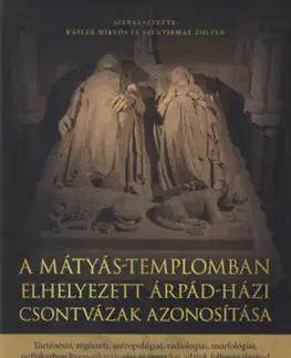 Archeológia, genealógia a heraldika A Mátyás-templomban elhelyezett Árpád-házi csontvázak azonosítása - Kolektív autorov