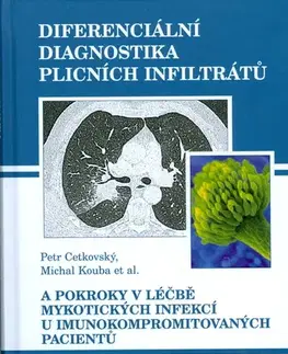 Medicína - ostatné Diferenciální diagnostika plicních infiltrátů - Petr Cetkovský