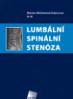 Medicína - ostatné Lumbální spinální stenóza - Blanka Adamová Mičánková