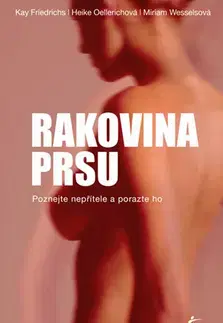 Onkológia Rakovina prsu - Heike Oellerich,Kolektív autorov