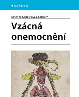 Medicína - ostatné Vzácná onemocnění - Kateřina Kopečková,Kolektív autorov