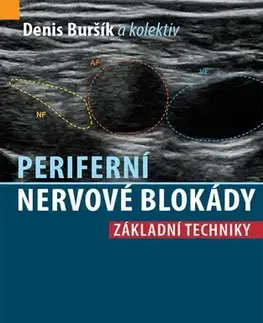 Medicína - ostatné Periferní nervové blokády - Denis Buršík