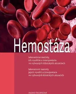 Medicína - ostatné Hemostáza, laboratorní metody, jejich využití a interpretace ve vybraných klinických situacích (3.vy - Ingrid Škorňová,Luděk Slavík,Tomáš Šimurda
