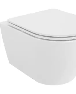 Záchody MEXEN/S - Carmen Závesná WC misa Rimless Tornado vrátane sedátka s slow slim, duroplast, biela lesk 30880300T